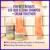 image:imageCalifornia Baby Eczema Body Wash amp Shampoo  Gentle SteroidFree Eczema Treatment  Colloidal Oatmeal  Aloe Vera  100 PlantBased  85 oz